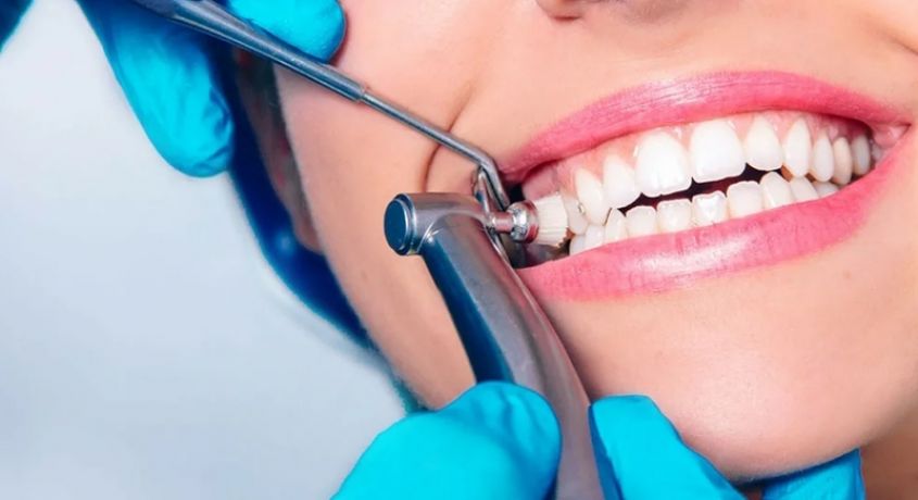 Профилактика здоровья зубов! Акция скидка 50% на профессиональную гигиену полости рта от стоматологической клиники «Империал Дент»