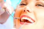 Импланты зубов в стоматологии