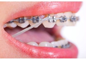 Прием стоматолога-ортодонта повторный (с составлением плана лечения)