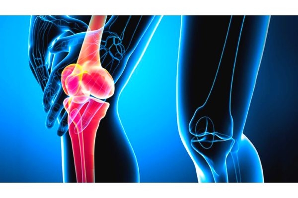 Ультразвуковое исследование коленных суставов