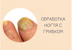 Обработка ногтя с грибком