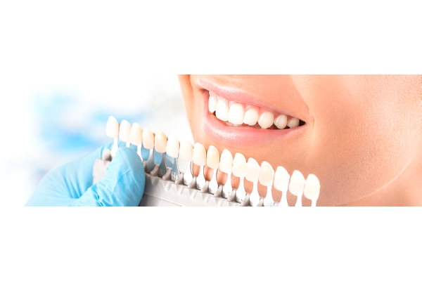 Керамические виниры на передние зубы