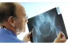 Рентгенография костей таза 