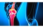 Ультразвуковое исследование коленных суставов