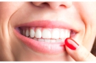 Услуги имплантации зубов