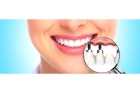 Зубной имплант верхнего зуба