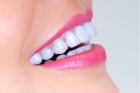 Коронки на передние нижние зубы
