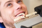 Керамические виниры для зубов