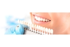 Керамические виниры на передние зубы