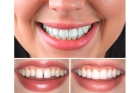 Реставрация верхних зубов
