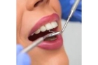Удаление зуба мудрости в стоматологии