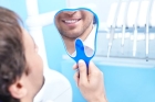 Восстановление культи зуба под ортопедическую коронку с использованием стекловолоконного штифта (Build Up)
