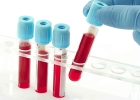 Анализ крови на фолиевую кислоту 