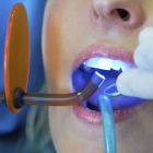 Пломбирование 1 канального зуба