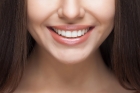Восстановление ряда зубов