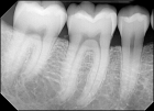 Снимок корней зубов