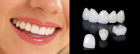 Диоксид циркония на передние зубы