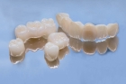 Циркониевая коронка на зуб
