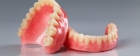 Пластиночное протезирование зубов