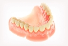 Съемный нижний зубной протез