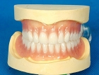 Съемный протез при полном отсутствии зубов