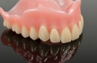 Пластиночный протез зубов